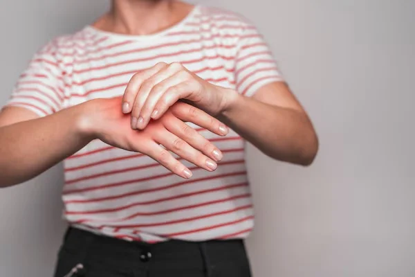 Carpal Tunnel Syndrome