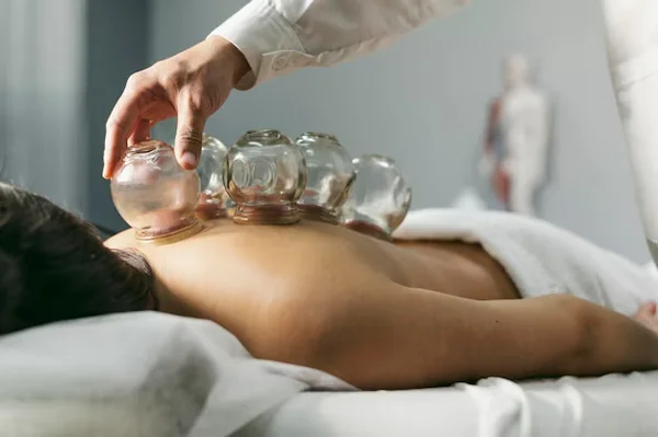 Cupping, Dry Needling, Potli & Toner Therapy